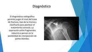 El diagnóstico radiográfico
permite juzgar el nivel del trazo
de fractura, tipo de la misma y
clasificarla para plantear el
tratamiento correcto. La
separación entre fragmentos
induciría a pensar en la
posibilidad de interposición de
partes blandas.
Diagnóstico
 