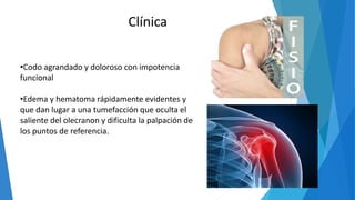 •Codo agrandado y doloroso con impotencia
funcional
•Edema y hematoma rápidamente evidentes y
que dan lugar a una tumefacción que oculta el
saliente del olecranon y dificulta la palpación de
los puntos de referencia.
Clínica
 