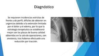 Se requieren incidencias estrictas de
frente y de perfil, difíciles de obtener en
urgencias debido a la extensión limitada
por el dolor y el edema, por lo que la
estrategia terapéutica se establecerá
mejor con las placas de buena calidad
obtenidas en la sala de operaciones, con
anestesia, tras haberse efectuado una
reducción por tracción.
Diagnóstico
 