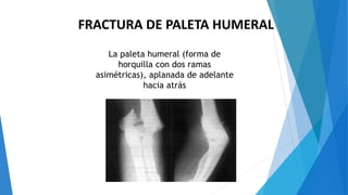 FRACTURA DE PALETA HUMERAL
La paleta humeral (forma de
horquilla con dos ramas
asimétricas), aplanada de adelante
hacia atrás
 