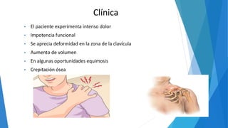 Clínica
• El paciente experimenta intenso dolor
• Impotencia funcional
• Se aprecia deformidad en la zona de la clavícula
• Aumento de volumen
• En algunas oportunidades equimosis
• Crepitación ósea
 