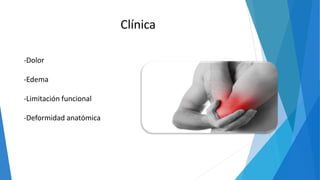 -Dolor
-Edema
-Limitación funcional
-Deformidad anatómica
Clínica
 