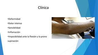 Clínica
•Deformidad
•Dolor intenso
•Sensibilidad
•Inflamación
•Imposibilidad ante la flexión y la prono
supinación
 