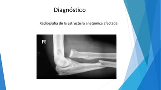 Diagnóstico
Radiografía de la estructura anatómica afectada
 