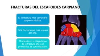 Es la fractura mas común del
carpo en adultos.
Es la fractura que mas se pasa
por alto.
El retardo en el diagnóstico
de la fractura altera el
pronostico de consolidación.
FRACTURAS DEL ESCAFOIDES CARPIANO
 