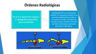 Órdenes Radiológicas
Radiografía PA con desviación
cubital: se colocara la mano en la
posición habitual de escribir o
con puño cerrado. Esta técnica
fue descrita por Schnek. Permite
ver bien las fracturas del polo
proximal y del istmo.
Rx A-P y lateral de muñeca:
y radiografia especifica
para escafoides.
 