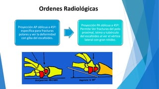 Proyección AP oblicua a 45º:
específica para fracturas
polares y ver la deformidad
con giba del escafoides.
Proyección PA oblicua a 45º:
Permite Ver fracturas del polo
proximal, istmo y tubérculo
del escafoides al ver el vértice
lateral con gran nitidez.
Ordenes Radiológicas
 