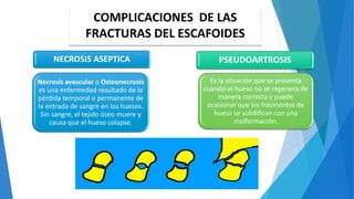 COMPLICACIONES DE LAS
FRACTURAS DEL ESCAFOIDES
NECROSIS ASEPTICA
Necrosis avascular o Osteonecrosis
es una enfermedad resultado de la
pérdida temporal o permanente de
la entrada de sangre en los huesos.
Sin sangre, el tejido óseo muere y
causa que el hueso colapse.
PSEUDOARTROSIS
Es la situación que se presenta
cuando el hueso no se regenera de
manera correcta y puede
ocasionar que los fracmentos de
hueso se solidifican con una
malformación.
 