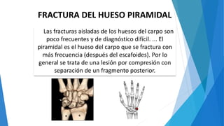 FRACTURA DEL HUESO PIRAMIDAL
Las fracturas aisladas de los huesos del carpo son
poco frecuentes y de diagnóstico difícil. ... El
piramidal es el hueso del carpo que se fractura con
más frecuencia (después del escafoides). Por lo
general se trata de una lesión por compresión con
separación de un fragmento posterior.
 