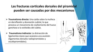 Las fracturas corticales dorsales del piramidal
pueden ser causadas por dos mecanismos
 Traumatismo directo: Una caída sobre la muñeca
en dorsiflexión y desviación cubital, lo que
provoca un mecanismo de cizallamiento del hueso
ganchoso o la estiloides del cúbito.
 Traumatismo indirecto: La distracción de
ligamentos óseos que ocasiona una avulsión
(ligamentos dorsales radiopiramidales y
escafopiramidales).
 
