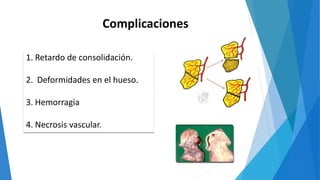 Complicaciones
1. Retardo de consolidación.
2. Deformidades en el hueso.
3. Hemorragia
4. Necrosis vascular.
 