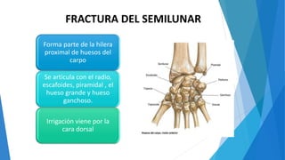 Forma parte de la hilera
proximal de huesos del
carpo
Se articula con el radio,
escafoides, piramidal , el
hueso grande y hueso
ganchoso.
Irrigación viene por la
cara dorsal
FRACTURA DEL SEMILUNAR
 