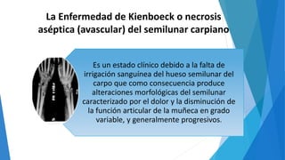 La Enfermedad de Kienboeck o necrosis
aséptica (avascular) del semilunar carpiano
Es un estado clínico debido a la falta de
irrigación sanguínea del hueso semilunar del
carpo que como consecuencia produce
alteraciones morfológicas del semilunar
caracterizado por el dolor y la disminución de
la función articular de la muñeca en grado
variable, y generalmente progresivos.
 