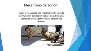 Suele ser una caída con hiperextensión forzada
de muñeca y desviación cubital o neutra o una
contusión directa sobre la cara dorsal de la
muñeca
Mecanismo de acción
 