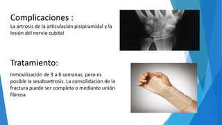 Tratamiento:
Inmovilización de 3 a 6 semanas, pero es
posible la seudoartrosis. La consolidación de la
fractura puede ser completa o mediante unión
fibrosa
Complicaciones :
La artrosis de la articulación pisipiramidal y la
lesión del nervio cubital
 