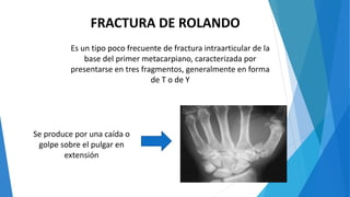 FRACTURA DE ROLANDO
Es un tipo poco frecuente de fractura intraarticular de la
base del primer metacarpiano, caracterizada por
presentarse en tres fragmentos, generalmente en forma
de T o de Y
Se produce por una caída o
golpe sobre el pulgar en
extensión
 