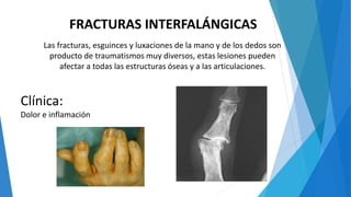 FRACTURAS INTERFALÁNGICAS
Las fracturas, esguinces y luxaciones de la mano y de los dedos son
producto de traumatismos muy diversos, estas lesiones pueden
afectar a todas las estructuras óseas y a las articulaciones.
Clínica:
Dolor e inflamación
 
