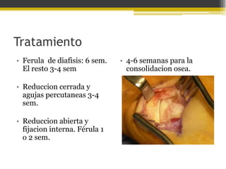 Tratamiento
• Ferula de diafisis: 6 sem.
El resto 3-4 sem

• Reduccion cerrada y
agujas percutaneas 3-4
sem.
• Reduccion abierta y
fijacion interna. Férula 1
o 2 sem.

• 4-6 semanas para la
consolidacion osea.

 