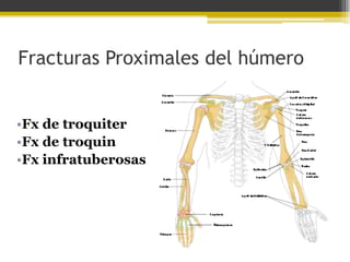 Fracturas Proximales del húmero
•Fx de troquiter
•Fx de troquin
•Fx infratuberosas

 