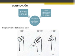CLASIFICACIÓN.
Por
luxación
el codo

Lesión
en valgo
Con base en
su
mecanismo
de lesión.

Desplazamiento de la cabeza radial

 