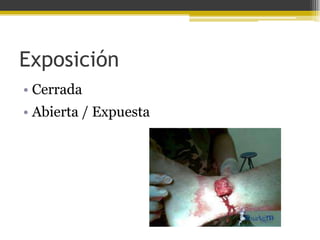 Exposición
• Cerrada
• Abierta / Expuesta

 