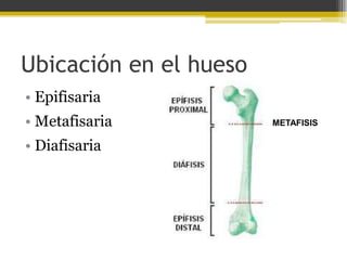 Ubicación en el hueso
• Epifisaria
• Metafisaria

• Diafisaria

METAFISIS

 