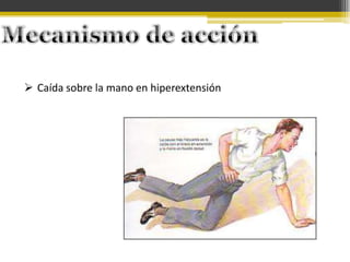  Caída sobre la mano en hiperextensión

 