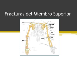 Fracturas del Miembro Superior

 