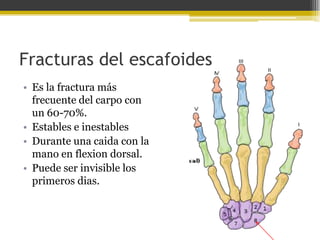 Fracturas del escafoides
• Es la fractura más
frecuente del carpo con
un 60-70%.
• Estables e inestables
• Durante una caida con la
mano en flexion dorsal.
• Puede ser invisible los
primeros dias.

 