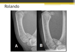 Rolando

 