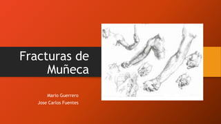 Fracturas de
Muñeca
Mario Guerrero
Jose Carlos Fuentes
 