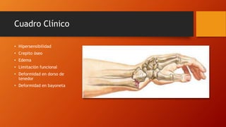 Cuadro Clínico
• Hipersensibilidad
• Crepito óseo
• Edema
• Limitación funcional
• Deformidad en dorso de
tenedor
• Deformidad en bayoneta
 
