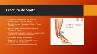 Fractura de Smith
• Fractura de epífisis distal del radio con
desplazamiento cubital y palmar.
• También llamada Fractura de Colles o Poteau
invertida.
• Necesita mayor impacto de fuerza que la
Fractura de Colles.
• Fracturas con angulación palmar, desplazamiento
palmar de la mano y del radio distal.
• Deformidad en pala de jardinero
• Caída sobre la muñeca flexionada con el
antebrazo fijo en supinacion
• Es una fractura notablemente inestable.
 