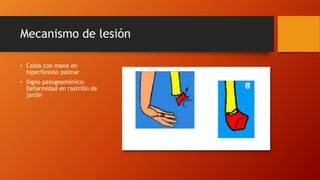 Mecanismo de lesión
• Caída con mano en
hiperflexión palmar
• Signo patognomónico:
Deformidad en rastrillo de
jardín
 