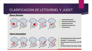 Judet Letournel Classification Fracturas de pelvis completa, clasificación .pdf