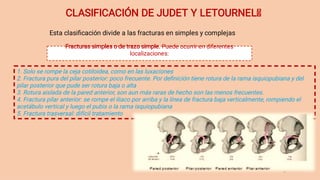 Jude Letournel Classification Fracturas de pelvis completa, clasificación .pdf