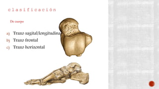 c l a s i f i c a c i ó n
a) Trazo sagital/longitudinal
b) Trazo frontal
c) Trazo horizontal
De cuerpo
 