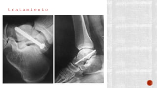 t r a t a m i e n t o
 