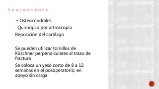t r a t a m i e n t o
¬ Osteocondrales
- Quirúrgico por artroscopia
Reposición del cartílago
Se pueden utilizar tornillos de
Kirschner perpendiculares al trazo de
fractura
Se coloca un yeso corto de 8 a 12
semanas en el posoperatorio; en
apoyo sin carga
 