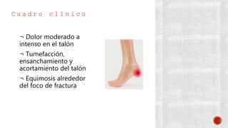C u a d r o c l í n i c o
¬ Dolor moderado a
intenso en el talón
¬ Tumefacción,
ensanchamiento y
acortamiento del talón
¬ Equimosis alrededor
del foco de fractura
 