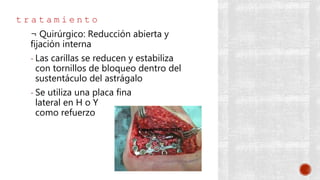 t r a t a m i e n t o
¬ Quirúrgico: Reducción abierta y
fijación interna
- Las carillas se reducen y estabiliza
con tornillos de bloqueo dentro del
sustentáculo del astrágalo
- Se utiliza una placa fina
lateral en H o Y
como refuerzo
 