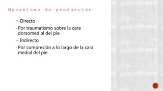 M e c a n i s m o d e p r o d u c c i ó n
¬ Directo
- Por traumatismo sobre la cara
dorsomedial del pie
¬ Indirecto
- Por compresión a lo largo de la cara
medial del pie
 