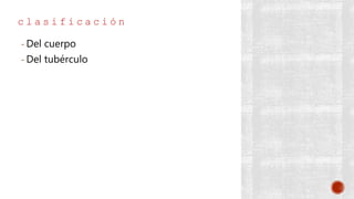 c l a s i f i c a c i ó n
- Del cuerpo
- Del tubérculo
 