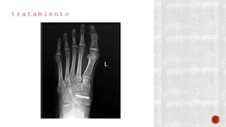 t r a t a m i e n t o
 
