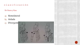 c l a s i f i c a c i ó n
a) Homolateral
b) Aislada
c) Divergente
De Ouenu y Kuss
 