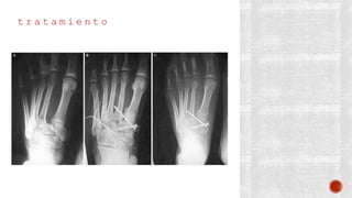 t r a t a m i e n t o
 