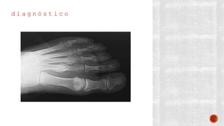 d i a g n ó s t i c o
 