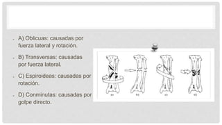 TIPOS DE FRACTURA
A) Oblicuas: causadas por
fuerza lateral y rotación.
B) Transversas: causadas
por fuerza lateral.
C) Espiroideas: causadas por
rotación.
D) Conminutas: causadas por
golpe directo.
 