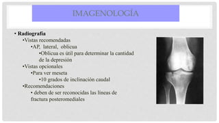 IMAGENOLOGÍA
• Radiografía
•Vistas recomendadas
•AP, lateral, oblicua
•Oblicua es útil para determinar la cantidad
de la depresión
•Vistas opcionales
•Para ver meseta
•10 grados de inclinación caudal
•Recomendaciones
• deben de ser reconocidas las líneas de
fractura posteromediales
 