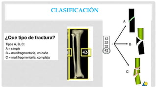 CLASIFICACIÓN
 